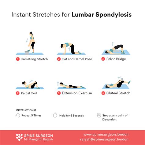 Lumbar spondylosis stretches spine surgeon london – Artofit