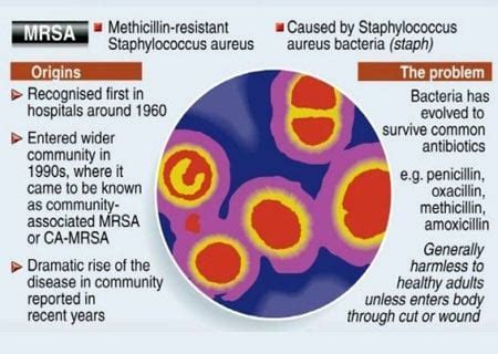 Infographic on MRSA Infection