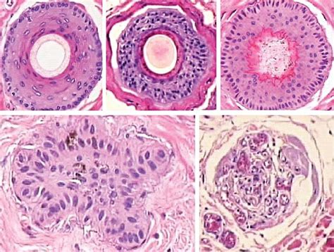 Hair Histology