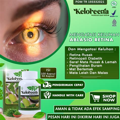 Jual Obat Ablasio Retina Saraf Mata Rusak Dan Lemah Retina Rusak Mata Berkabut Katarak Berlemak ...