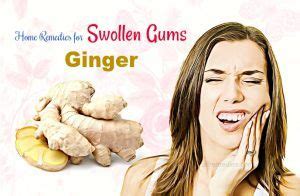 20 Useful Home Remedies for Swollen Gums Around Tooth