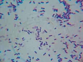 Gardnerella vaginalis. Observación microscópica con objetivo de 40x. | Download Scientific Diagram