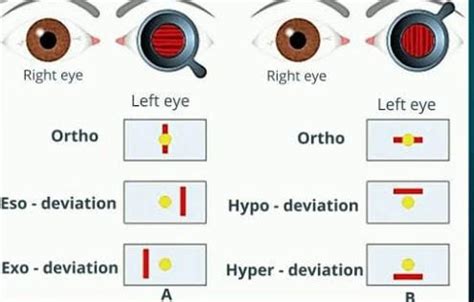 ESOPHORIA - Optography