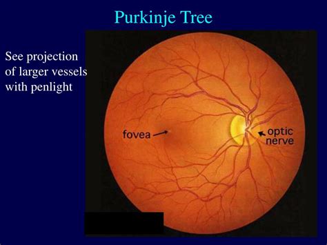 PPT - Entoptic Phenomena of Retinal Origin PowerPoint Presentation ...