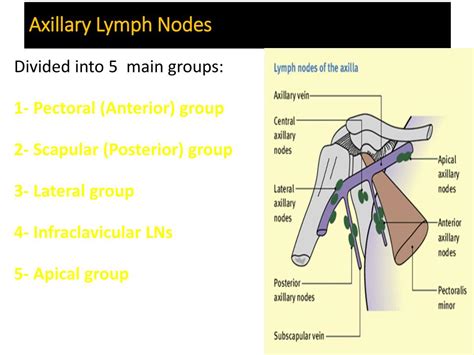 Axillary Lymph Nodes Cancer