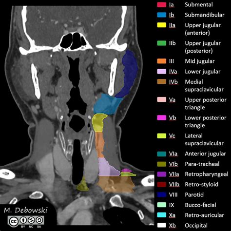 Cervical Lymph Nodes Radiopaedia | Images and Photos finder