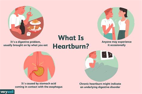 What Does Severe Heartburn Feel Like? Understanding The Discomfort