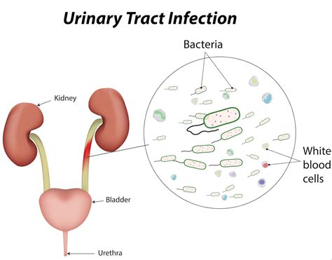 Proteus meaning - iumloxa