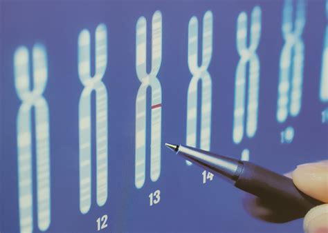 Tumore seno, Zuradelli onkologa: Dori aniqligi bo'yicha genetik test