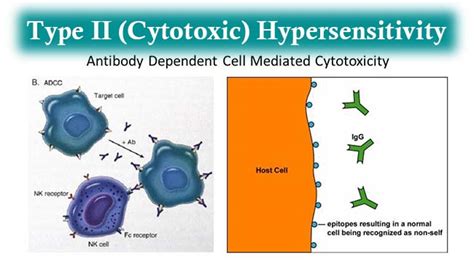 Type II (Cytotoxic) Hypersensitivity- Mechanism and Examples