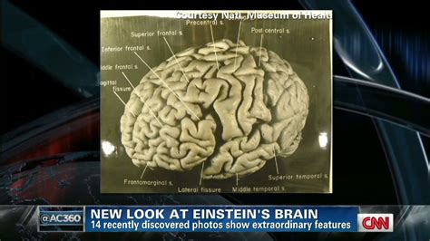 Albert Einsteins Brain