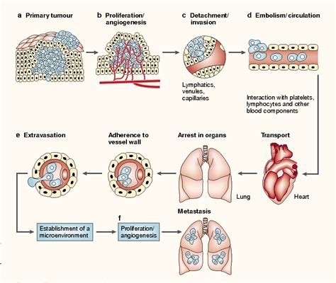 Figure 2 from The pathogenesis of cancer metastasis: the 'seed and soil' hypothesis revisited ...