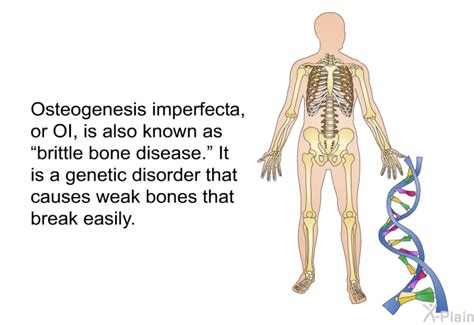 PatEdu.com : Osteogenesis Imperfecta