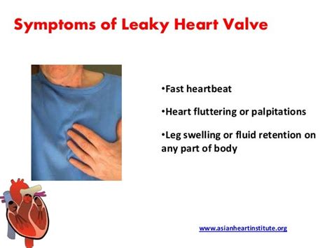 Asian Heart Institute - Leaky heart valve symptoms