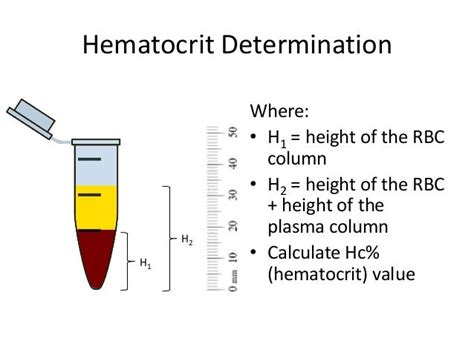 Download What Is Hba1c Or A1c | Gantt Chart Excel Template