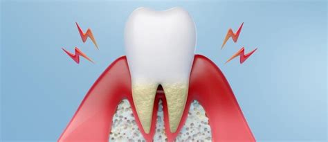 Loose Tooth: Causes, Prevention, and Treatment