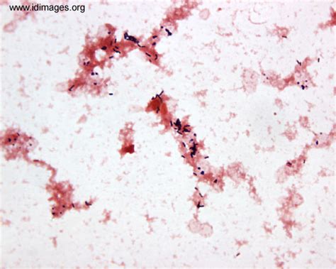 Listeria Monocytogenes Gram Stain Images - img-Aaralyn