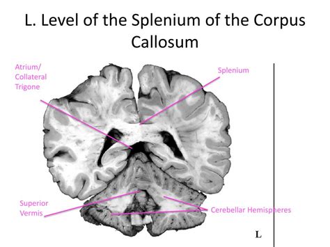 PPT - Lab 3a Internal Anatomy of Brain Horizontal Sections PowerPoint Presentation - ID:2016915