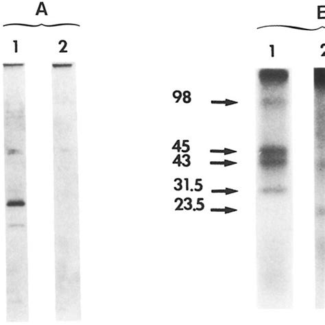 (A) SDS-PAGE analysis of platelet lysate eluted from BBI0 affinity ...