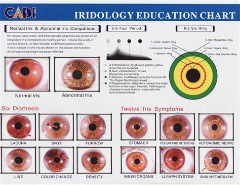 bernard jensen iridology chart Here's a Quick Way to Get It | iriscope ...