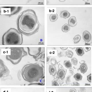 SEM images of untreated Bacillus amyloliquefaciens spores (a) or B ...