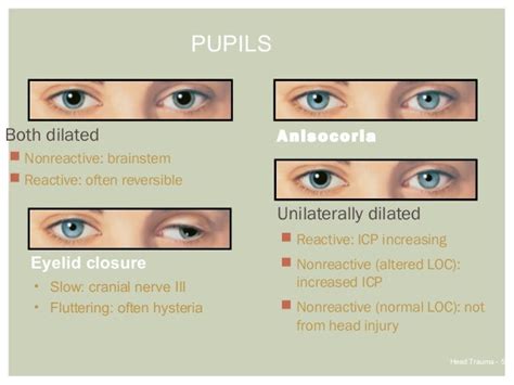 Pin by Miroslawa Bodnar on PA | Icu nursing, Picu nurse, Nursing mnemonics