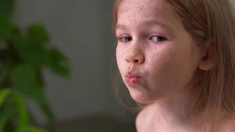 Little girl with freckles puffs cheeks, makes face — Stock Video © sayfutdinov #349673158