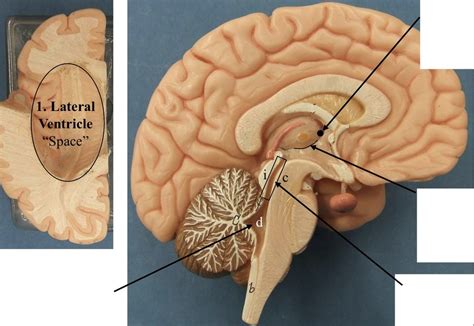 Flow of Cerebral Spinal Fluid Diagram | Quizlet