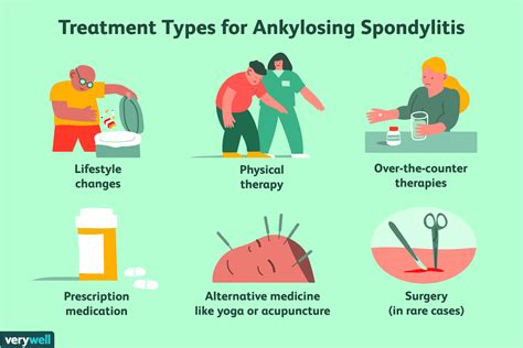 Wie wird Spondylitis ankylosans behandelt? - MedDe