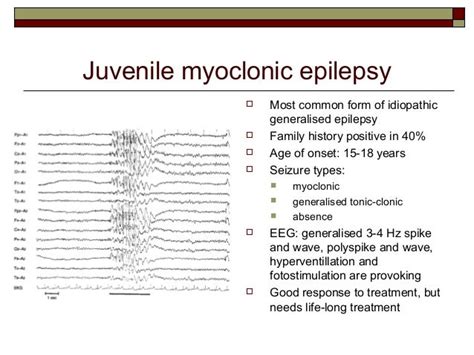 Epilepsy