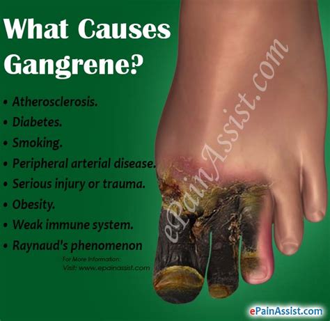 GANGRENE