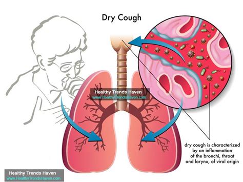 All You Need To Know About Coughs: Types, Causes and Symptoms | Healthy ...