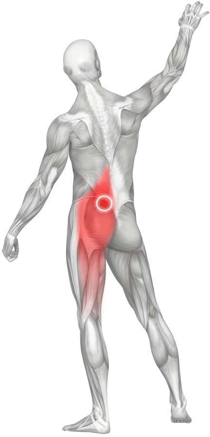 Massage for Upper Gluteal Pain (Gluteus Maximus)