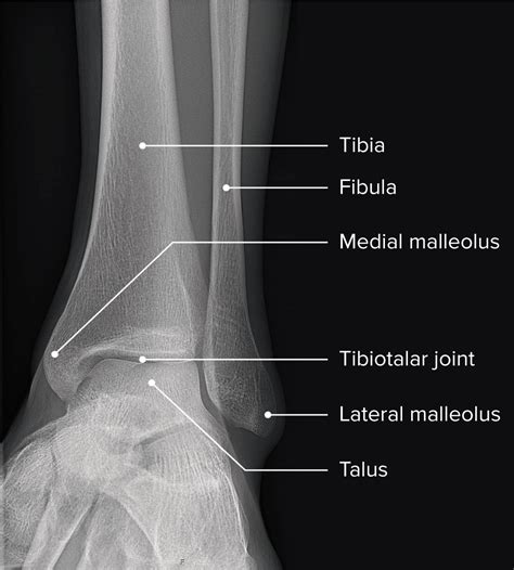 Ankle Joint: Anatomy | Concise Medical Knowledge