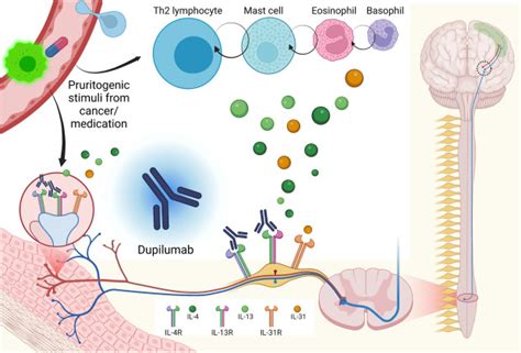 Dupilumab for cancer-associated refractory pruritus - Journal of Allergy and Clinical Immunology ...