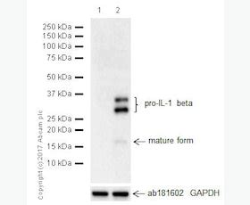 Recombinant Anti-IL-1 beta antibody [EPR16805-15] (ab234437) | Abcam