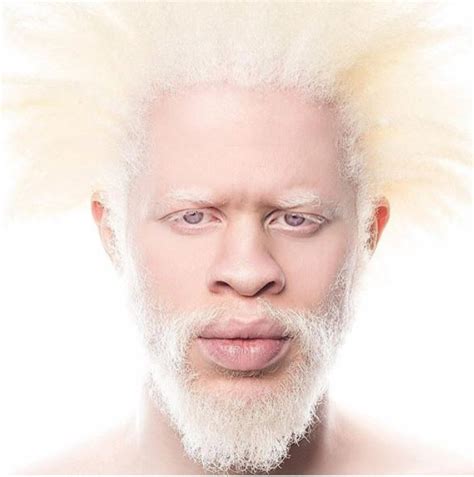 Is This Albino Guy Hot? Omotola Jalade-Ekeinde Asks (pictured) - Celebrities - Nigeria