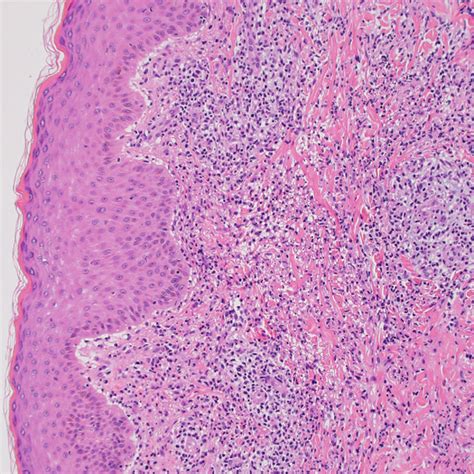 Neutrophils Histology