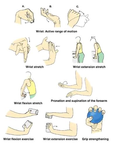 Wrist Sprain Exercises