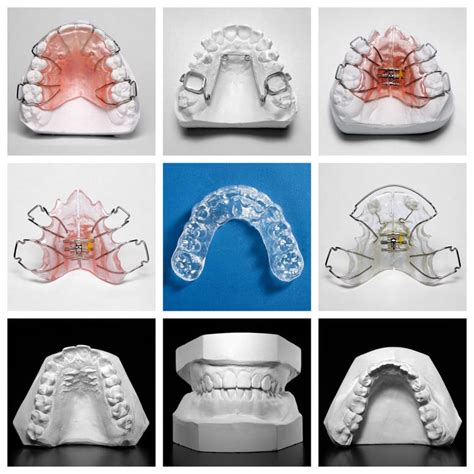 Dentofacial Orthopedics | McDonough Orthodontics