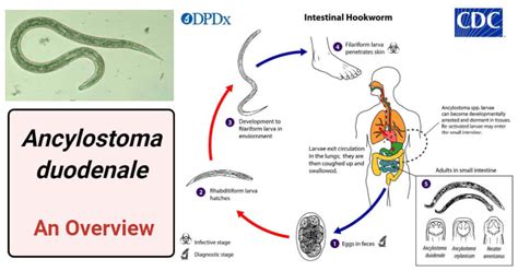 Ancylostoma duodenale- An Overview - Microbe Notes