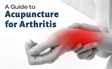 Acupuncture for Rheumatoid Arthritis and Osteoarthritis