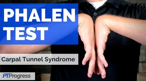 Phalen Test for Carpal Tunnel Syndrome - YouTube