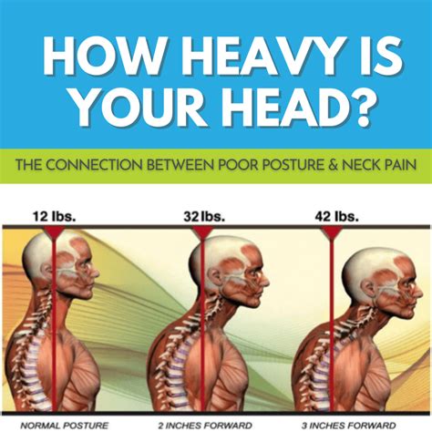 Poor Posture & Neck Pain - Melanie Massey Physical Therapy