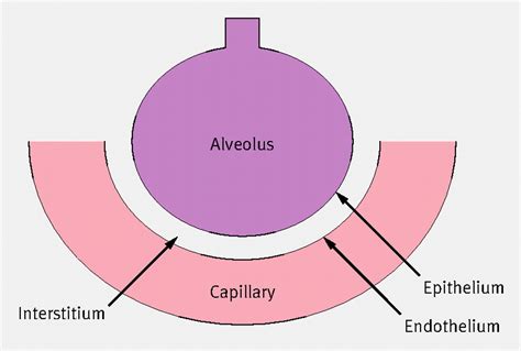 How to investigate a patient with suspected interstitial lung disease | The BMJ