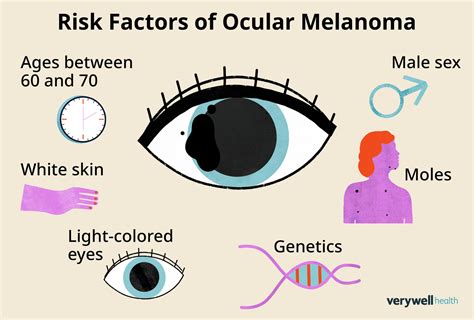 Ocular Melanoma Diagnosis Treatment Symptoms Cancer C - vrogue.co