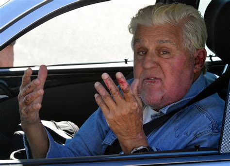 Jay Leno spotted driving into same garage as car fire