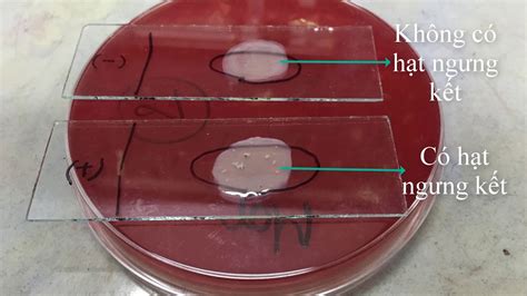 Thử nghiệm Coagulase - Slide and Tube Coagulase Test - Nhóm 2 - Tổ 3 - Xét nghiệm 9B - HMTU ...