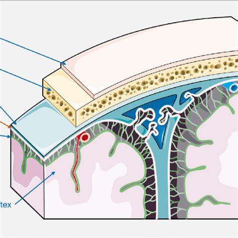 Typical MRI radiographic features of meningioma | Download Scientific Diagram