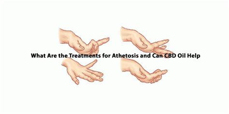 Athetosis Treatment - Can CBD Help Manage Athetosis Symptoms? | SmartCBDHub